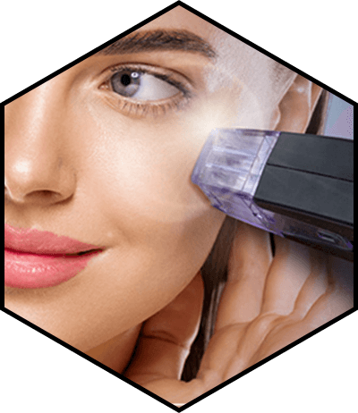 Morpheus8 - радиочастотная подтяжка лица