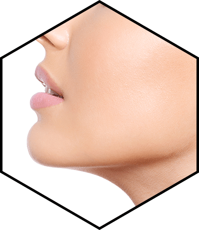 остеотомия челюсти Бимакс Тримакс