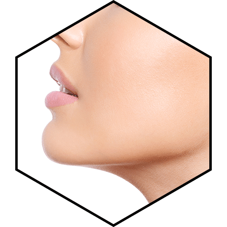 Подробнее о статье Остеотомия челюсти