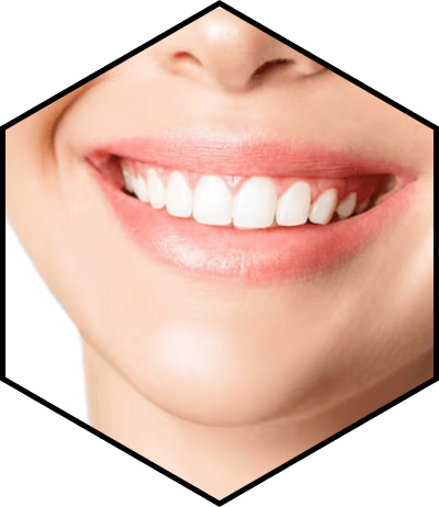 расширение челюсти Алматы